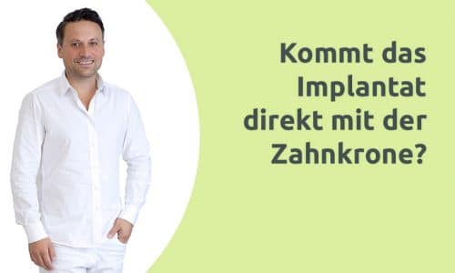 Erklärvideo - Implantat und Krone