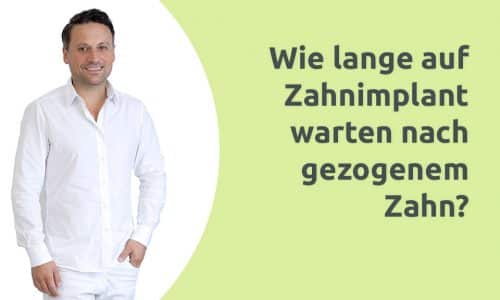 Erklärvideo - Wie lange warten auf Zahnimplantat nach gezogenem Zahn