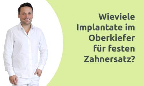 Erklärvideo - Wieviele Implantate im Oberkiefer