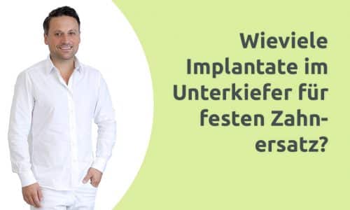 Erklärvideo - Implantate im Unterkiefer für festen Zahnersatz