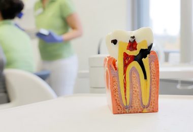 Kariöser Zahn