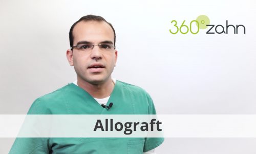 Video Allograft