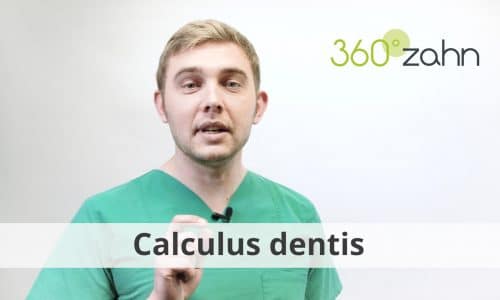 Video - Calculus dentis