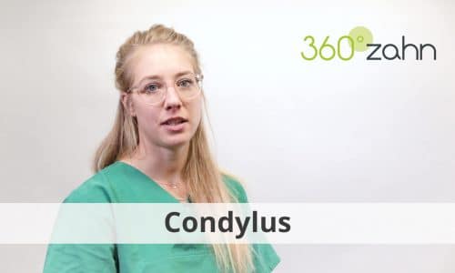 Video Condylus