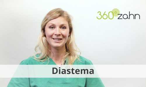 Video - Diastema
