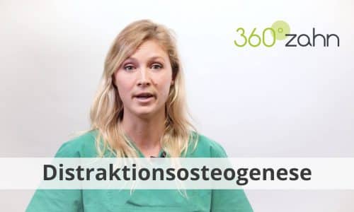 Video Distraktionsosteogenese