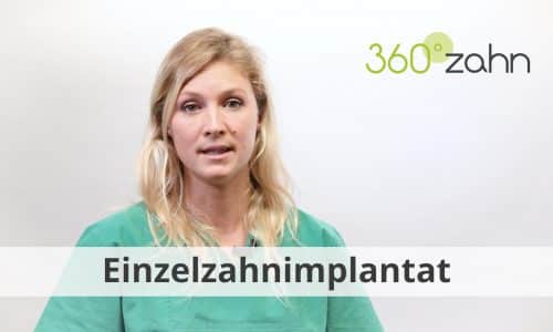 Video Einzelzahnimplantat