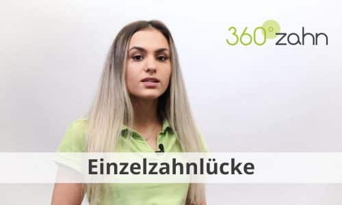 Video Einzelzahnlücke