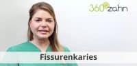 Video - Fissurenkaries