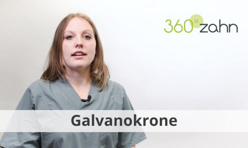 Video Galvanokrone