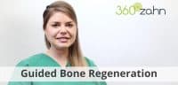 Video - Guided Bone Regeneration