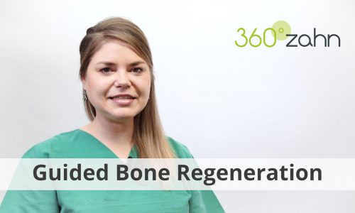 Video - Guided Bone Regeneration