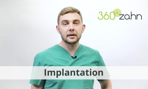 Video - Implantation