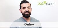 Video - Onlay