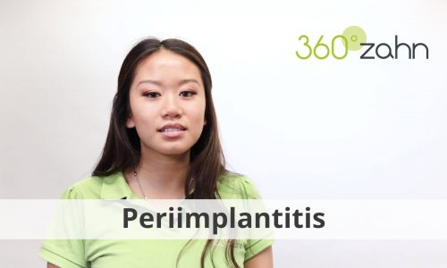 Video Periimplantitis