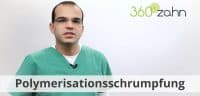 Video - Polymerisationsschrumpfung