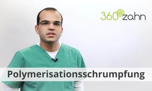 Video - Polymerisationsschrumpfung