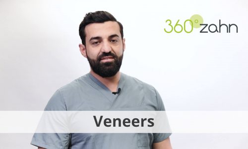 Video Veneers