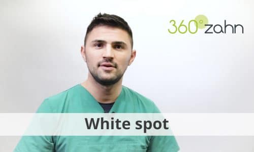 Video White Spot