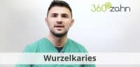 Video Wurzelkaries