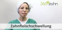 Video Zahnfleischschwellung