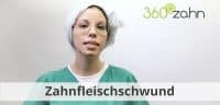 Video Zahnfleischschwund