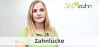 Video Zahnlücke