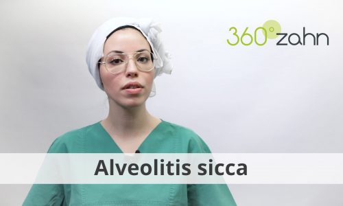 Video - Alveolitis sicca