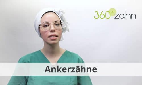 Video - Ankerzähne