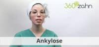 Video - Ankylose