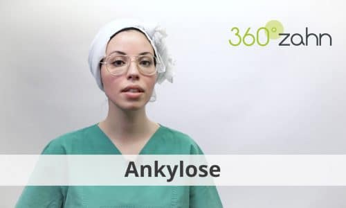 Video - Ankylose