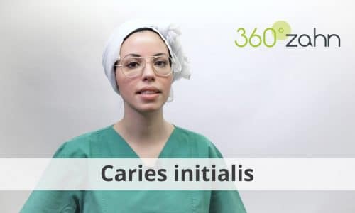 Video - Caries initialis