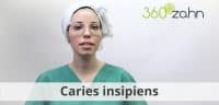 Video - Caries insipiens