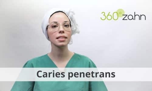 Video - Caries penetrans