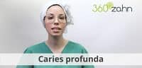 Video - Caries profunda