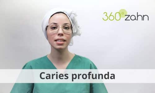 Video - Caries profunda