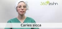 Video - Caries sicca