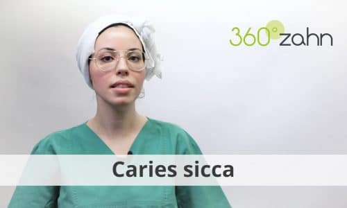 Video - Caries sicca