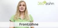 Video - Frontzähne