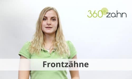 Video - Frontzähne