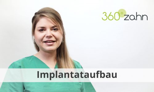 Video - Impantataufbau