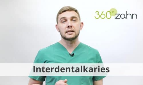 Video - Interdentalkaries