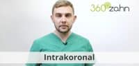 Video - Intrakoronal