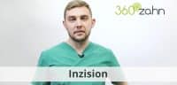 Video - Inzision