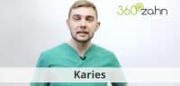 Video - Karies