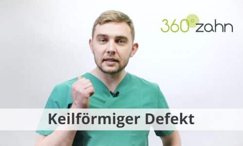 Video - Keilförmiger Defekt