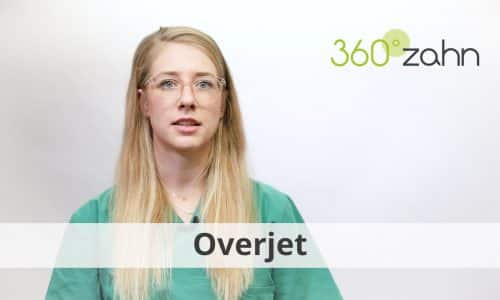 Video - Overjet