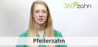 Video - Pfeilerzahn
