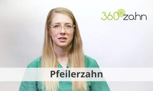 Video - Pfeilerzahn