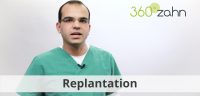 Video - Replantation